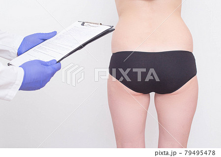 A plastic surgeon examines a patient s buttocks before installing silicone implants. The concept of buttock enlargement, shaping and volume, figure correction A plastic surgeon examines a patient s buttocks before installing silicone implants. The concept of buttock enlargement, shaping and volume, figure correction 79495478
