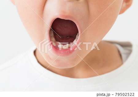 口を開ける子供 口を開ける子供 79502522