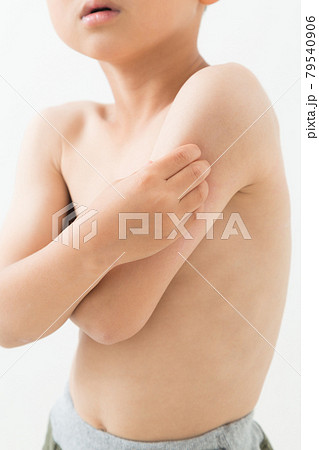 体を掻く子供 79540906