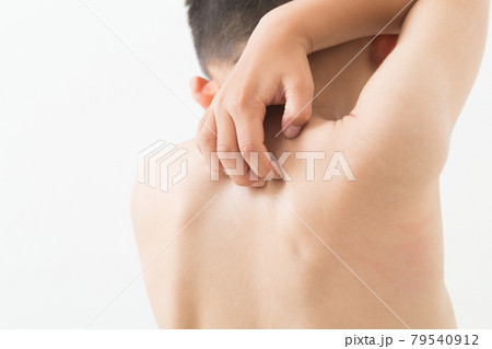 体を掻く子供 79540912