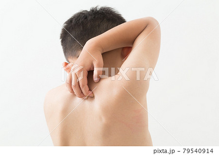 体を掻くこども 79540914