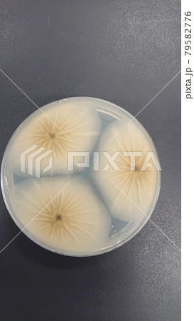 黒麴カビの培養 79582776