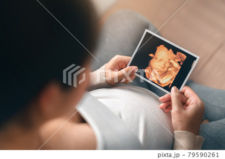 Asian pregnant woman holding ultrasound 4d scan image, Expectation of a child and Maternity prenatal care and woman pregnancy concept. Asian pregnant woman holding ultrasound 4d scan image, Expectation of a child and Maternity prenatal care and woman pregnancy concept. 79590261