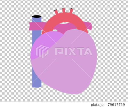 Illustration of a simple heart. Impairment is a condition. No outline. 79617739
