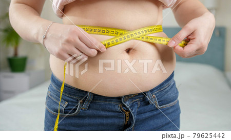 Closeup of young woman with fat belly measuring her waistline. Concept of dieting, unhealthy lifestyle, overweight and obesity. 79625442