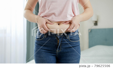CLoseup of young woman in jeans holding fat fold on her belly. Concept of excessive weight, obese female, dieting and overweight problems 79625506