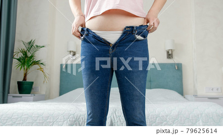 Young woman with excess weight dressing up in bedroom. Concept of excessive weight, obese female, dieting and overweight problems 79625614