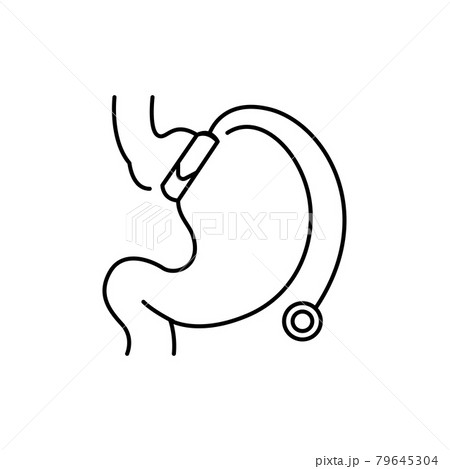 Gastric lap-band olor line icon. Pictogram for web page, mobile app, promo. Gastric lap-band olor line icon. Pictogram for web page, mobile app, promo. 79645304