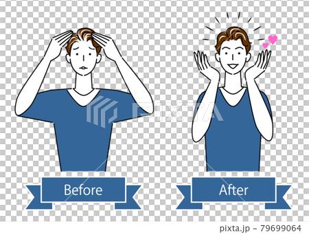 ヘアケア 薄毛 白髪 頭髪のトラブルのビフォーアフター 可愛い男性 イラスト シンプル ベクター ヘアケア 薄毛 白髪 頭髪のトラブルのビフォーアフター 可愛い男性 イラスト シンプル ベクター 79699064