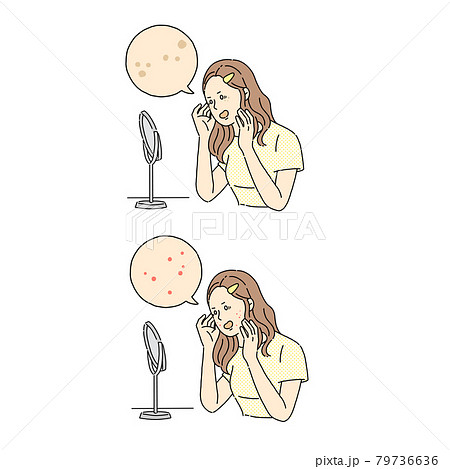 女性、美容、肌荒れ、ニキビ、吹き出物 女性、美容、肌荒れ、ニキビ、吹き出物 79736636