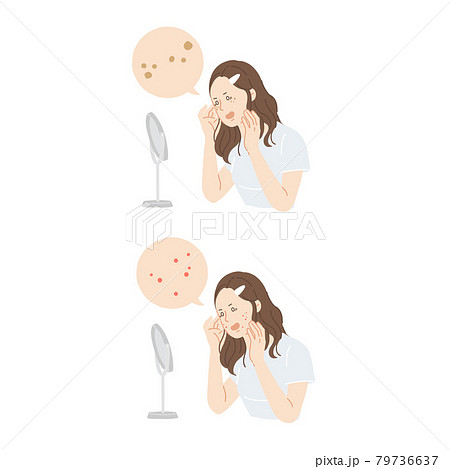 女性、美容、肌荒れ、ニキビ、吹き出物 79736637