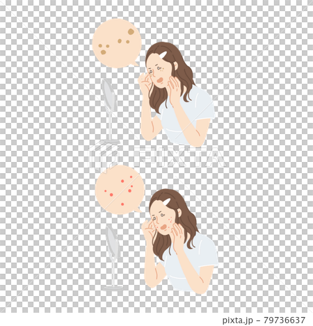 女性、美容、肌荒れ、ニキビ、吹き出物 79736637