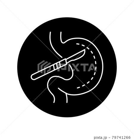 Stomach surgery olor line icon. Pictogram for web page, mobile app, promo. Stomach surgery olor line icon. Pictogram for web page, mobile app, promo. 79741266