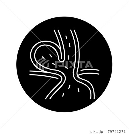 Hiatal hernia olor line icon. Pictogram for web page, mobile app, promo. Hiatal hernia olor line icon. Pictogram for web page, mobile app, promo. 79741271