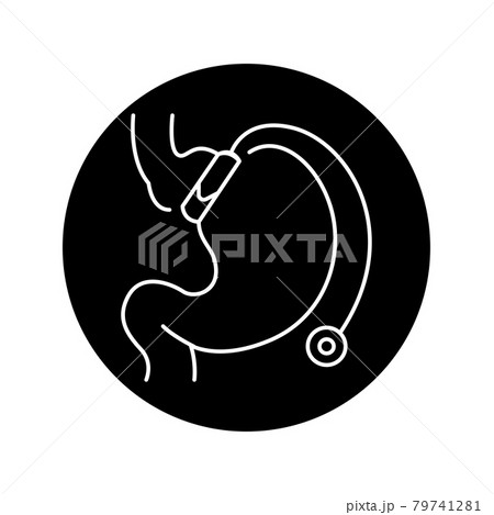 Gastric lap-band olor line icon. Pictogram for web page, mobile app, promo. Gastric lap-band olor line icon. Pictogram for web page, mobile app, promo. 79741281