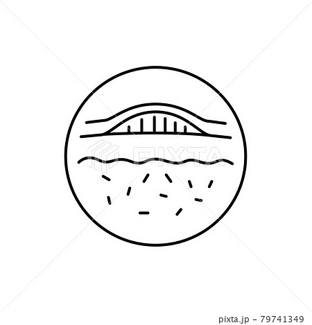Bruise black line icon. Dermatology disease. Isolated vector element. Bruise black line icon. Dermatology disease. Isolated vector element. 79741349