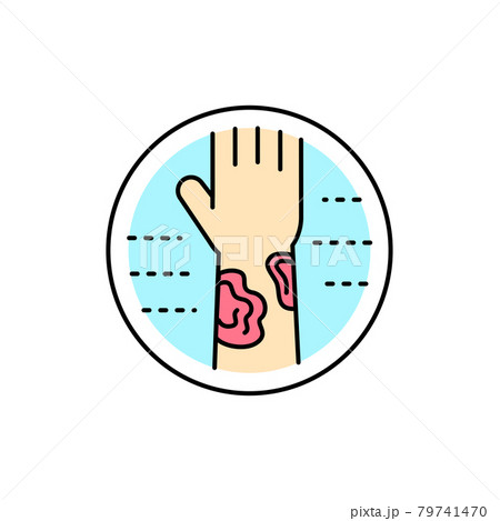 Lichen planus color line icon. Dermatology disease. Isolated vector element. Lichen planus color line icon. Dermatology disease. Isolated vector element. 79741470