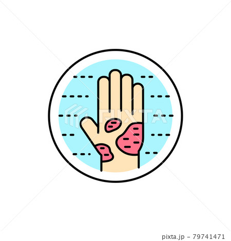Eczema color line icon. Dermatology disease. Isolated vector element. Eczema color line icon. Dermatology disease. Isolated vector element. 79741471