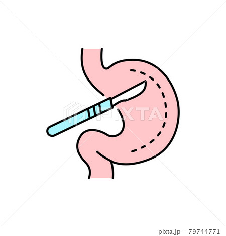 Stomach surgery olor line icon. Pictogram for web page, mobile app, promo. 79744771