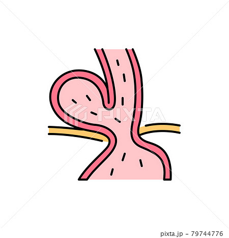 Hiatal hernia olor line icon. Pictogram for web page, mobile app, promo. 79744776