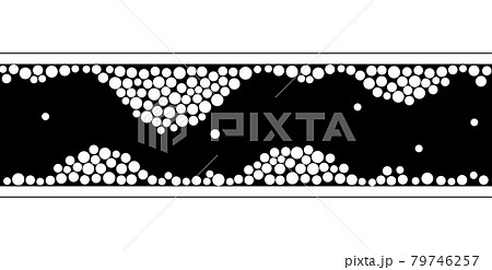 Cholesterol and atherosclerosis 79746257