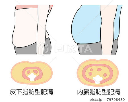 肥満のタイプ 男性と女性の違いのイラストのイラスト素材