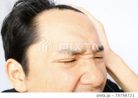おでこの広い日本人男性のクローズアップ 79798721