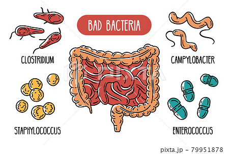 Vector infographics of the bad human gut bacteria 79951878