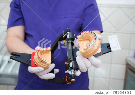 model of the jaw in the articulator in the hand of a young doctor. The dentist shows the unfolded articulator model of the jaw in the articulator in the hand of a young doctor. The dentist shows the unfolded articulator 79954351