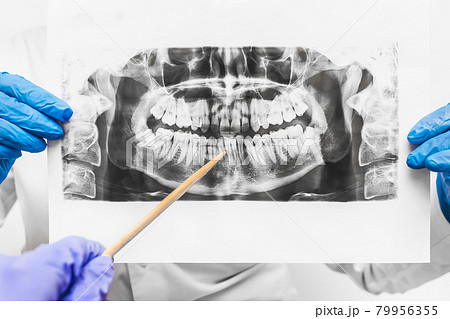 Hands of a man and a woman doctor in protective medical gloves hold and study an x-ray picture of teeth 79956355