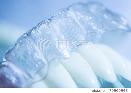 Invisible bracket aligners Invisible bracket aligners 79969948