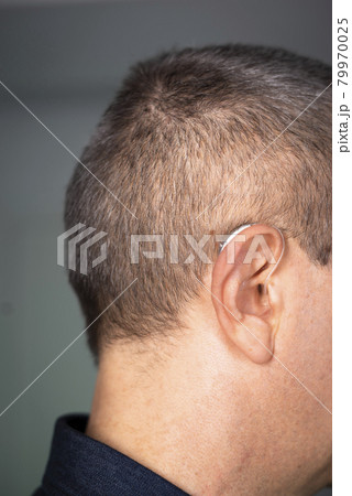 Hearing aid ear of man 79970025