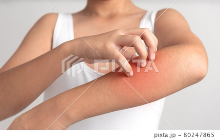 Itching in man Itching in man 80247865