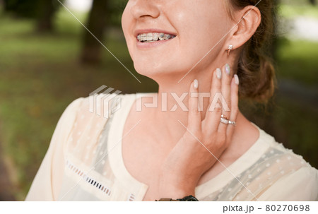 Cropped portrait of a pretty girl, smiling and demonstrating her teeth with braces Cropped portrait of a pretty girl, smiling and demonstrating her teeth with braces 80270698