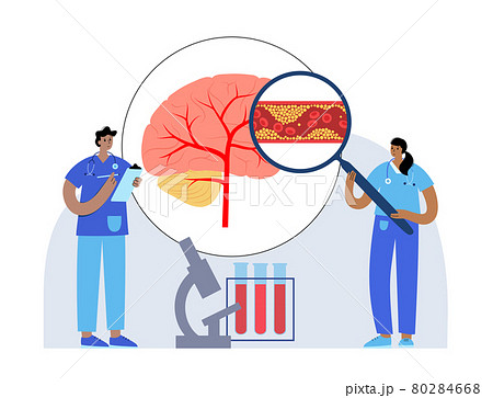 Brain stroke ishemic 80284668