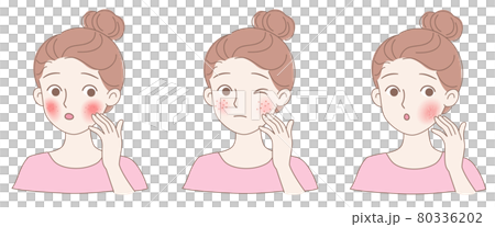 Three types of facial skin problems: allergies, itchy skin, acne and dry skin 80336202