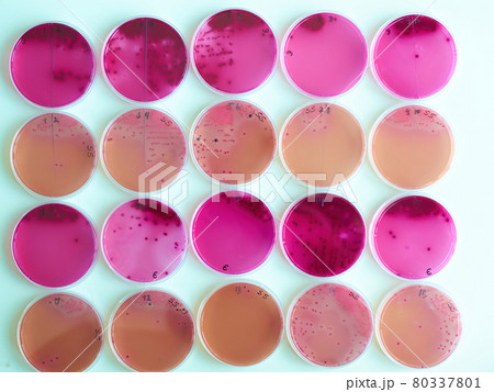 Petri dish with selective growth medium colonies of enteric bacteria Petri dish with selective growth medium colonies of enteric bacteria 80337801