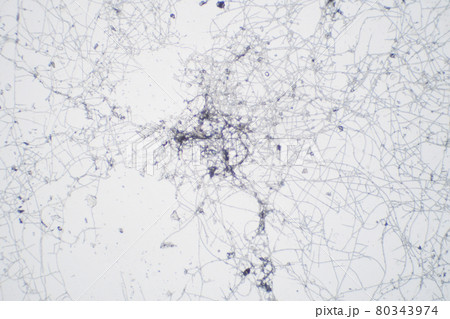 顕微鏡で見たカビ 80343974