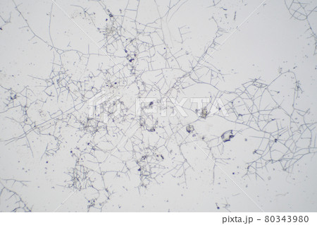 顕微鏡で見たカビ 80343980