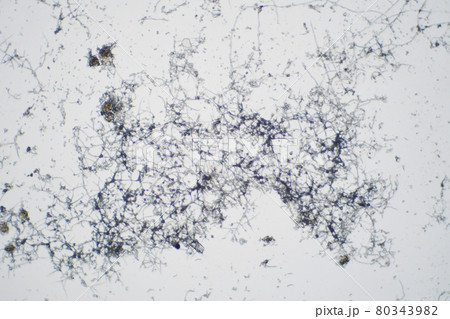 顕微鏡で見たカビ 80343982