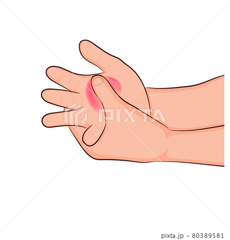 image graphics vector outline Wrist pain is often caused by sprains or fractures from sudden injuries concept health care image graphics vector outline Wrist pain is often caused by sprains or fractures from sudden injuries concept health care 80389581