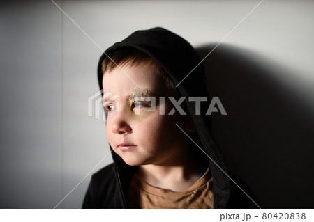 Poor sad small boy with cut eyebrow standing indoors at home, poverty concept. 80420838