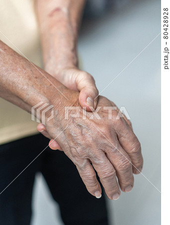 Guillain-Barre Syndrome GBS, Peripheral Neuropathy pain in elderly patient on hand, fingers, sensory nerves with numb, muscle weakness from chronic inflammatory demyelinating polyneuropathy 80428928