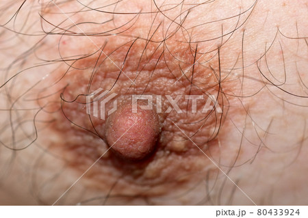 The nipple of the breast of a fat man. The nipple of the breast of a fat man. 80433924