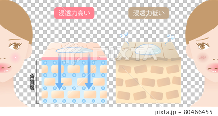 高滲透皮膚和低滲透皮膚女性和橫截面 80466455