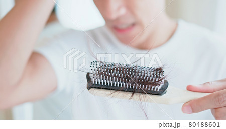man worry about hair loss 80488601