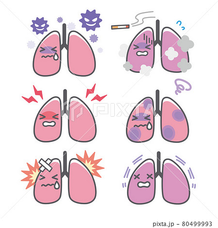 人間の肺のダメージに関する表情セットのイラスト素材