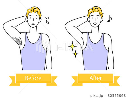 ムダ毛処理 わき毛を脱毛する可愛い男性のビフォーアフター イラスト シンプル ベクター ムダ毛処理 わき毛を脱毛する可愛い男性のビフォーアフター イラスト シンプル ベクター 80525068