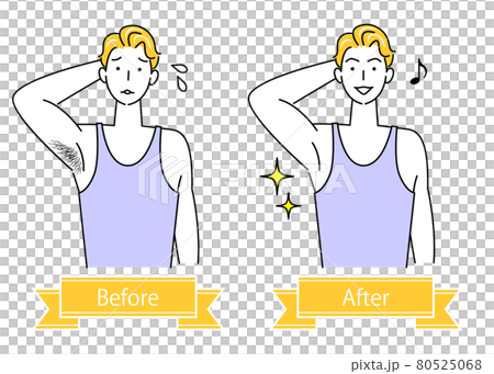 Unwanted hair treatment Before and after illustration of a cute man who removes armpit hair Simple vector Unwanted hair treatment Before and after illustration of a cute man who removes armpit hair Simple vector 80525068