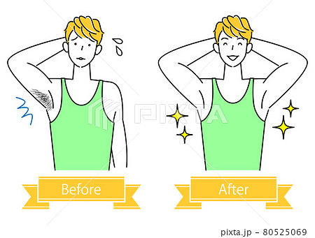 ムダ毛処理 わき毛を脱毛する可愛い男性のビフォーアフター イラスト シンプル ベクター ムダ毛処理 わき毛を脱毛する可愛い男性のビフォーアフター イラスト シンプル ベクター 80525069
